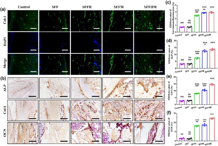 https://cdn.ncbi.nlm.nih.gov/pmc/blobs/f3dd/7705190/9f9386c05a84/10.1177_2041731420967791-fig9.jpg
