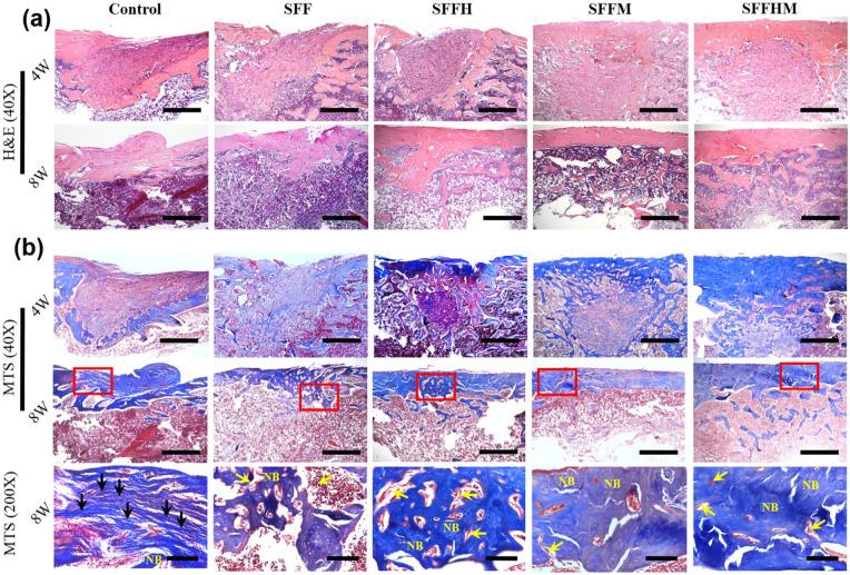 https://cdn.ncbi.nlm.nih.gov/pmc/blobs/f3dd/7705190/af846e75a179/10.1177_2041731420967791-fig8.jpg