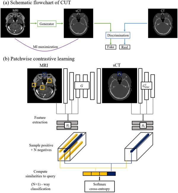 https://cdn.ncbi.nlm.nih.gov/pmc/blobs/f3de/9680583/091ce52c1fa0/ACM2-23-e13775-g007.jpg