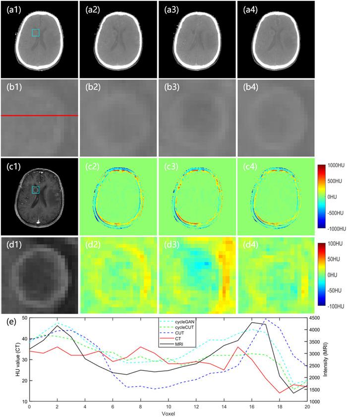 https://cdn.ncbi.nlm.nih.gov/pmc/blobs/f3de/9680583/3c4fa1d1fb59/ACM2-23-e13775-g006.jpg