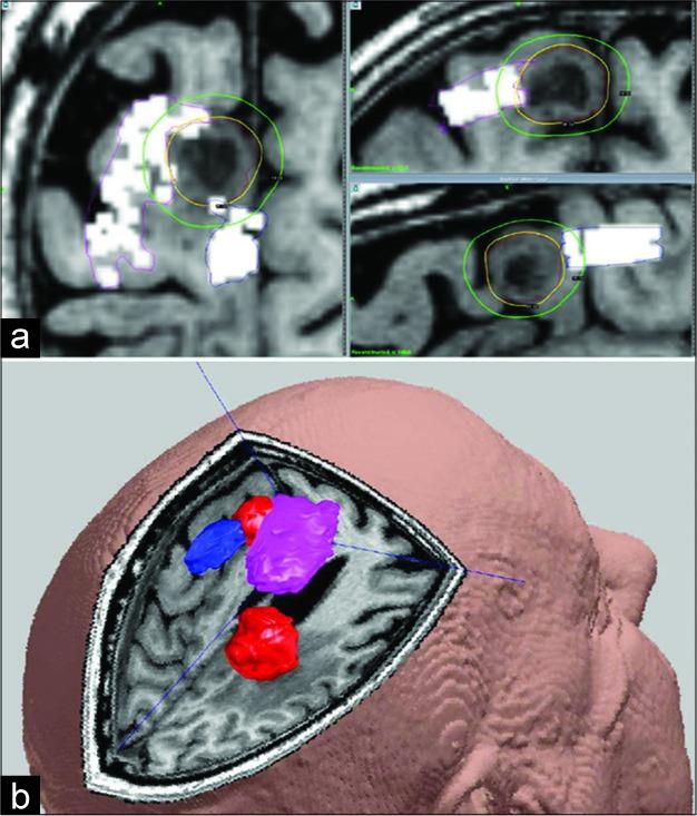 https://cdn.ncbi.nlm.nih.gov/pmc/blobs/f3e8/7110065/8cc4fb70fab4/SNI-11-29-g002.jpg