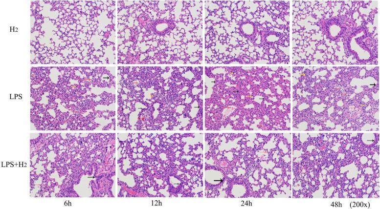 https://cdn.ncbi.nlm.nih.gov/pmc/blobs/f3e9/9575233/a0b53f87d44f/12950_2022_314_Fig4_HTML.jpg