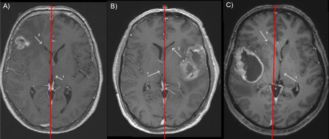 https://cdn.ncbi.nlm.nih.gov/pmc/blobs/f3f1/11329426/6af9b556e85c/12021_2024_9671_Figb_HTML.jpg