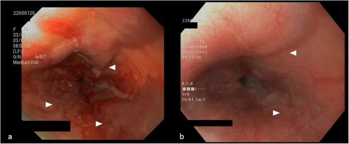 https://cdn.ncbi.nlm.nih.gov/pmc/blobs/f3f8/5426764/5847b5b7bb4c/pone.0177401.g004.jpg