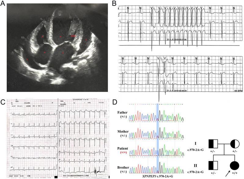 https://cdn.ncbi.nlm.nih.gov/pmc/blobs/f401/11451151/9f7be03315aa/12887_2024_5124_Fig1_HTML.jpg
