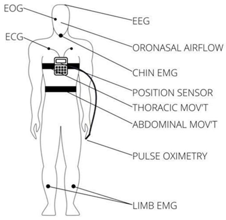 https://cdn.ncbi.nlm.nih.gov/pmc/blobs/f402/10708697/d3f4c4f9fc90/sensors-23-09512-g001.jpg
