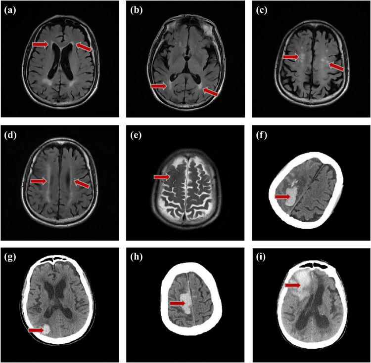 https://cdn.ncbi.nlm.nih.gov/pmc/blobs/f405/7885301/668452a2c738/j_med-2021-0212-fig002.jpg