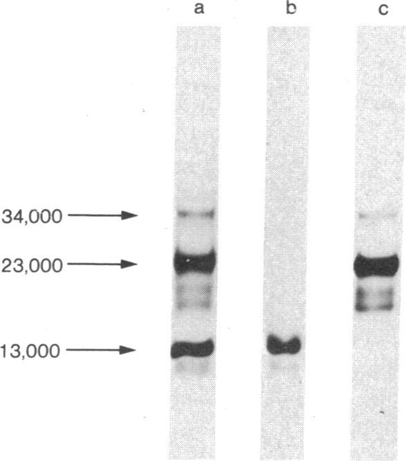 https://cdn.ncbi.nlm.nih.gov/pmc/blobs/f40c/431819/9328191ea8c6/pnas00031-0387-g.jpg