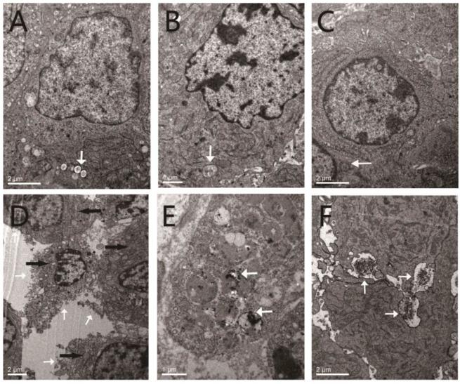https://cdn.ncbi.nlm.nih.gov/pmc/blobs/f410/4143943/5822d7d6bb8d/thnov04p1026g010.jpg