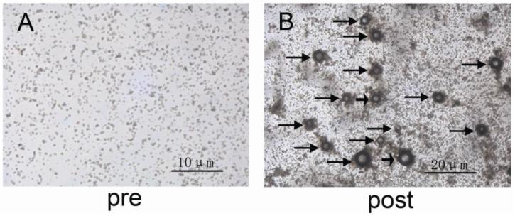 https://cdn.ncbi.nlm.nih.gov/pmc/blobs/f410/4143943/cff7f197b4ab/thnov04p1026g003.jpg