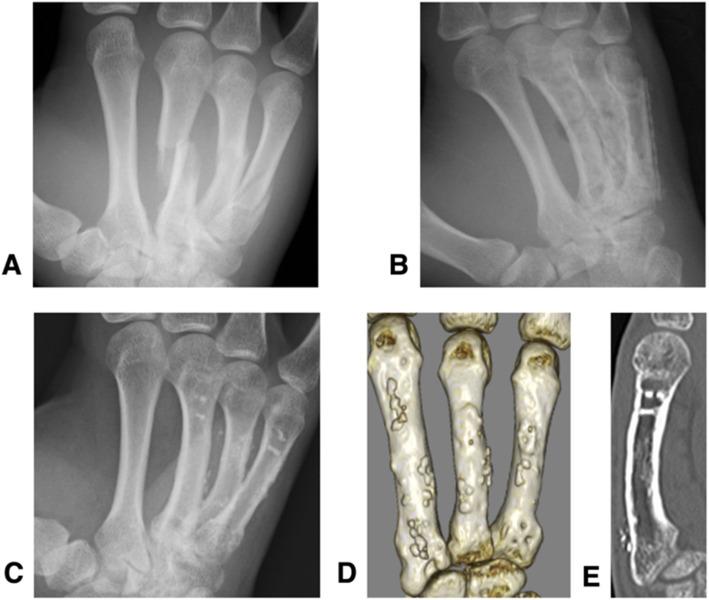 https://cdn.ncbi.nlm.nih.gov/pmc/blobs/f416/7722336/e92a5ed16dcc/12891_2020_3841_Fig4_HTML.jpg