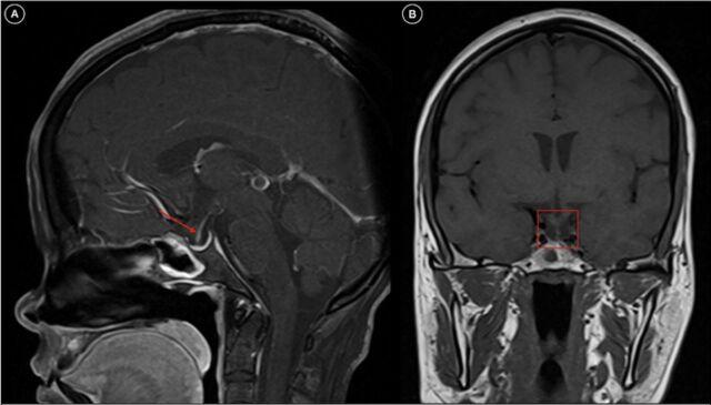 https://cdn.ncbi.nlm.nih.gov/pmc/blobs/f419/11398623/d38fae71c8c4/toj-24-0019-figure2.jpg