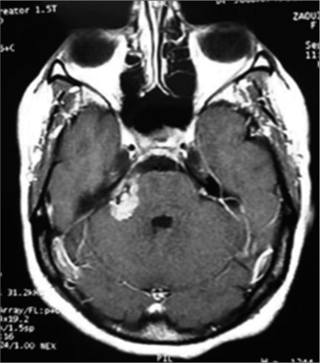 https://cdn.ncbi.nlm.nih.gov/pmc/blobs/f420/9609808/f54508ffa402/SNI-13-414-g002.jpg