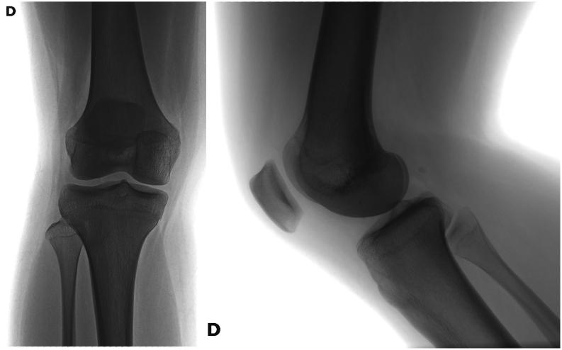 https://cdn.ncbi.nlm.nih.gov/pmc/blobs/f421/9069856/f96ce7c19feb/EOR-21-0110fig4.jpg