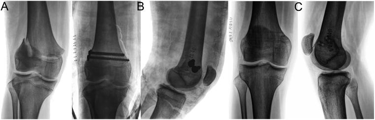 https://cdn.ncbi.nlm.nih.gov/pmc/blobs/f421/9069856/fb6205c8ac0d/EOR-21-0110fig16.jpg