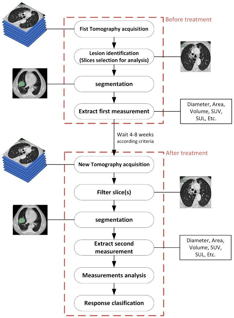 https://cdn.ncbi.nlm.nih.gov/pmc/blobs/f425/12298732/4ea63387d3dd/tomography-11-00078-g003.jpg