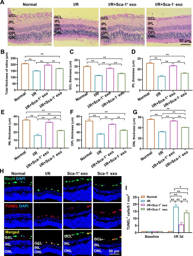 https://cdn.ncbi.nlm.nih.gov/pmc/blobs/f42a/10268362/d6f41b00e759/12951_2023_1944_Fig3_HTML.jpg