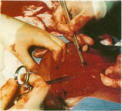 https://cdn.ncbi.nlm.nih.gov/pmc/blobs/f430/2351909/1f1e82aaac9e/bmj00557-0057-a.jpg