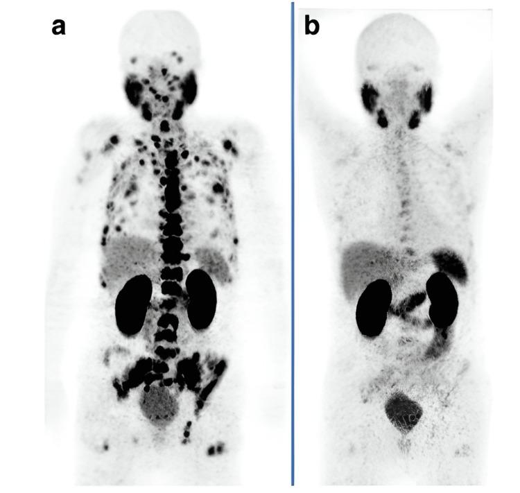 https://cdn.ncbi.nlm.nih.gov/pmc/blobs/f430/9584169/ebf32a376f2d/cureus-0014-00000029369-i01.jpg