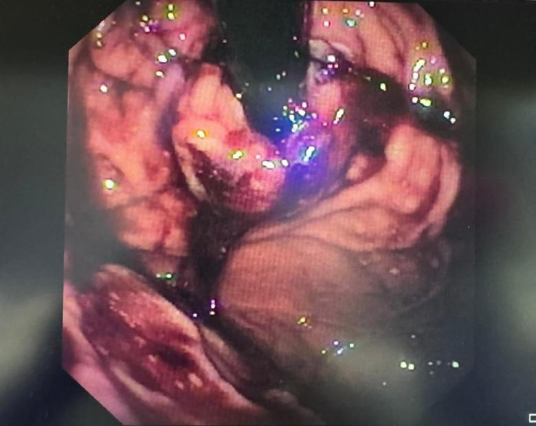 https://cdn.ncbi.nlm.nih.gov/pmc/blobs/f431/11514428/63838ca7ecd4/WJGE-16-557-g002.jpg