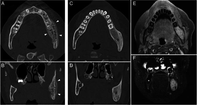 https://cdn.ncbi.nlm.nih.gov/pmc/blobs/f433/11579154/2752947bd08f/247_2024_6079_Fig7_HTML.jpg
