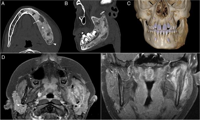 https://cdn.ncbi.nlm.nih.gov/pmc/blobs/f433/11579154/976264887678/247_2024_6079_Fig6_HTML.jpg