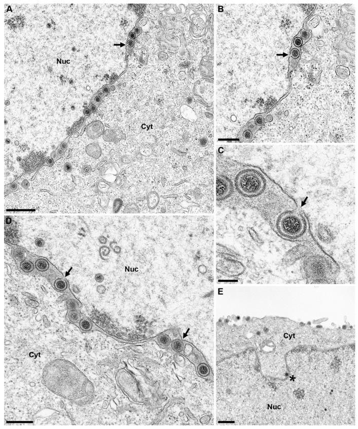 https://cdn.ncbi.nlm.nih.gov/pmc/blobs/f434/7140721/79bba7bf3c59/cells-09-00738-g010.jpg