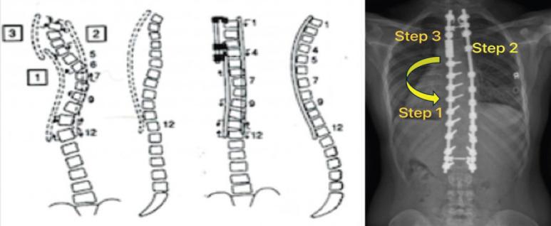 https://cdn.ncbi.nlm.nih.gov/pmc/blobs/f435/12237445/9609106b9629/JOCR-15-282-g002.jpg