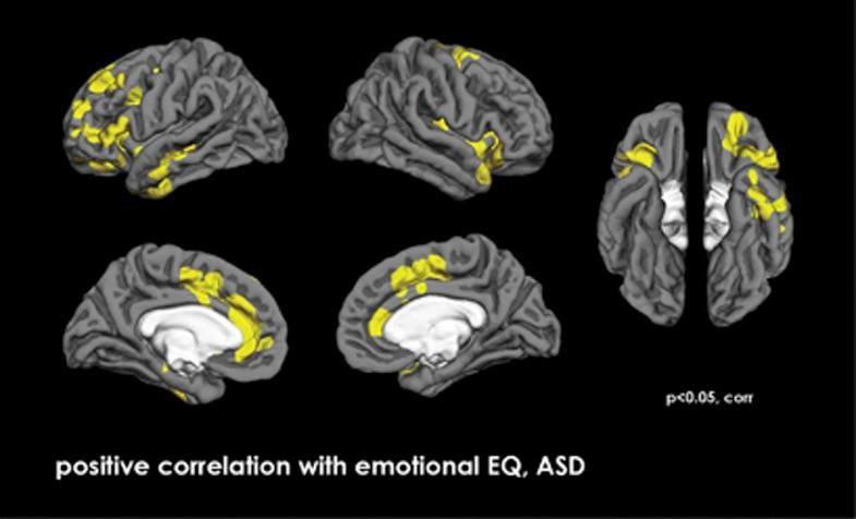 https://cdn.ncbi.nlm.nih.gov/pmc/blobs/f43a/3905223/423183066474/tp2013113f3.jpg