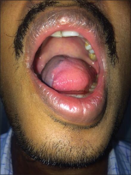 https://cdn.ncbi.nlm.nih.gov/pmc/blobs/f43a/6018300/f52005aefa3e/AMS-8-61-g008.jpg