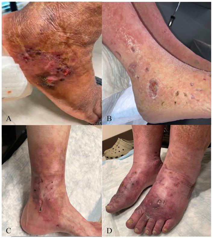 https://cdn.ncbi.nlm.nih.gov/pmc/blobs/f43c/9732787/07c50cdfd63d/10.1177_1358863X221130380-fig2.jpg