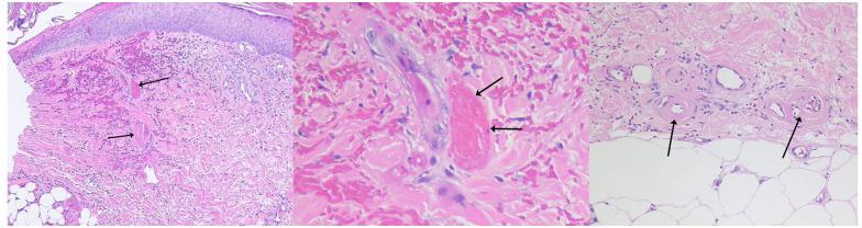 https://cdn.ncbi.nlm.nih.gov/pmc/blobs/f43c/9732787/4f39228a844c/10.1177_1358863X221130380-fig3.jpg