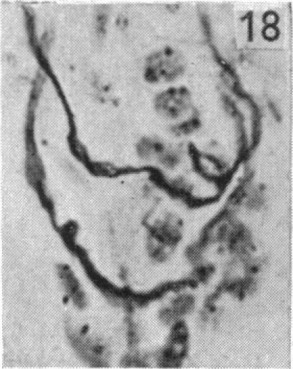 https://cdn.ncbi.nlm.nih.gov/pmc/blobs/f443/1244845/cf6addc478cc/janat00456-0076-i.jpg