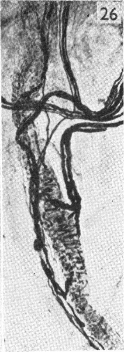 https://cdn.ncbi.nlm.nih.gov/pmc/blobs/f443/1244845/fd387cd9c090/janat00456-0077-d.jpg
