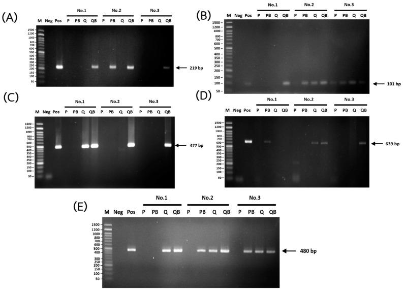 https://cdn.ncbi.nlm.nih.gov/pmc/blobs/f444/9689707/441a7f079b41/diagnostics-12-02588-g006.jpg