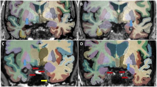 https://cdn.ncbi.nlm.nih.gov/pmc/blobs/f445/11977048/b2cf1edc77f7/JON-35-0-g002.jpg
