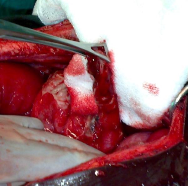 https://cdn.ncbi.nlm.nih.gov/pmc/blobs/f448/2876173/433e65fa5599/1752-1947-4-134-2.jpg