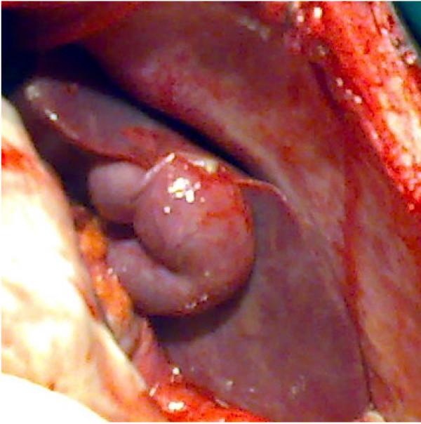 https://cdn.ncbi.nlm.nih.gov/pmc/blobs/f448/2876173/eb99c2b10258/1752-1947-4-134-1.jpg