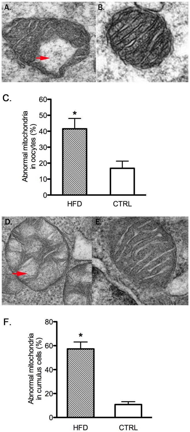 https://cdn.ncbi.nlm.nih.gov/pmc/blobs/f452/3495769/7f002fcdb655/pone.0049217.g004.jpg