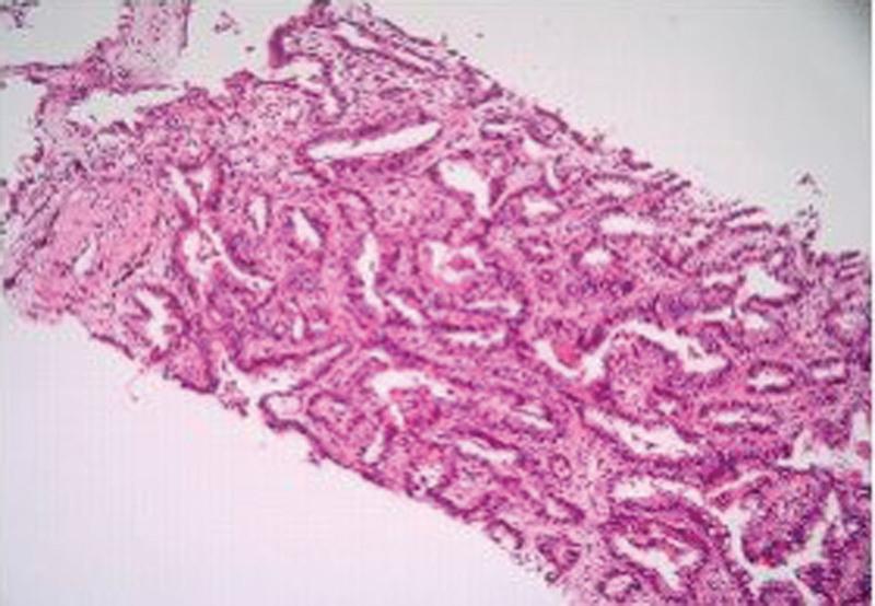 https://cdn.ncbi.nlm.nih.gov/pmc/blobs/f454/10194617/a0829975534a/medi-102-e33774-g001.jpg