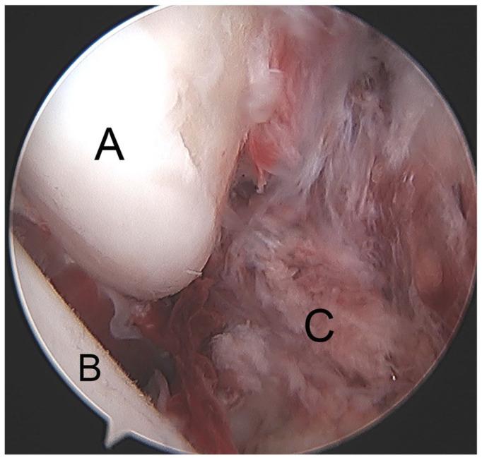 https://cdn.ncbi.nlm.nih.gov/pmc/blobs/f45b/8246108/3d1a83ec6943/eor-6-420-g005.jpg