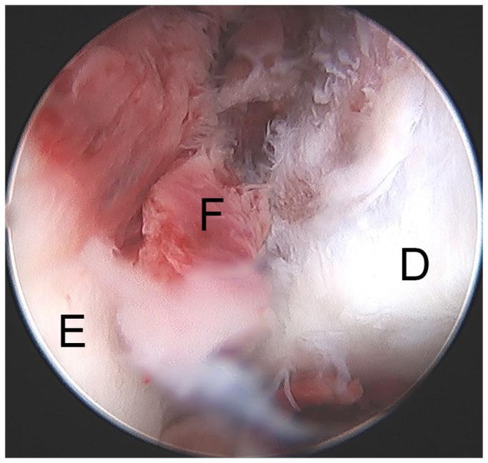 https://cdn.ncbi.nlm.nih.gov/pmc/blobs/f45b/8246108/6050e844df89/eor-6-420-g006.jpg