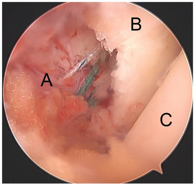 https://cdn.ncbi.nlm.nih.gov/pmc/blobs/f45b/8246108/627d97b9e88f/eor-6-420-g008.jpg