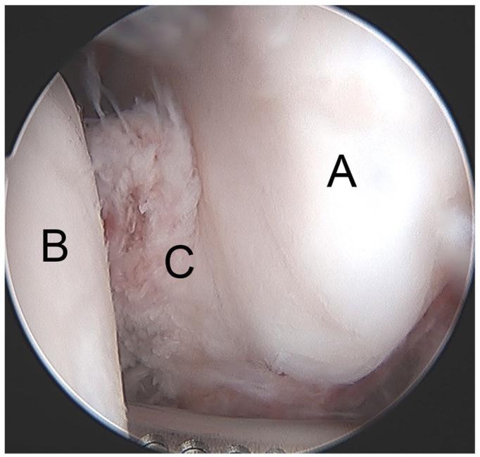 https://cdn.ncbi.nlm.nih.gov/pmc/blobs/f45b/8246108/b0d26175ee8c/eor-6-420-g004.jpg