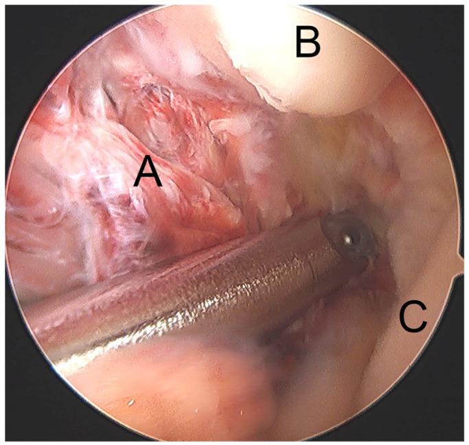 https://cdn.ncbi.nlm.nih.gov/pmc/blobs/f45b/8246108/c488d69508b8/eor-6-420-g007.jpg
