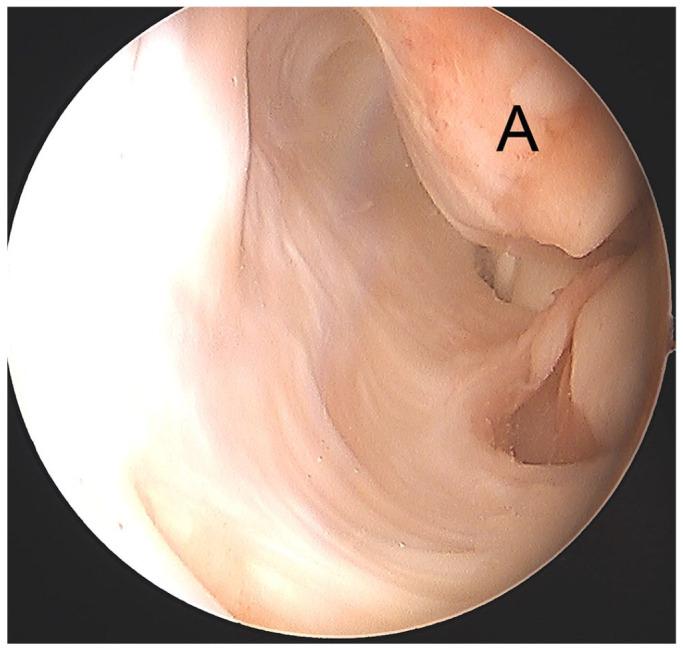 https://cdn.ncbi.nlm.nih.gov/pmc/blobs/f45b/8246108/cd331f7466ef/eor-6-420-g001.jpg