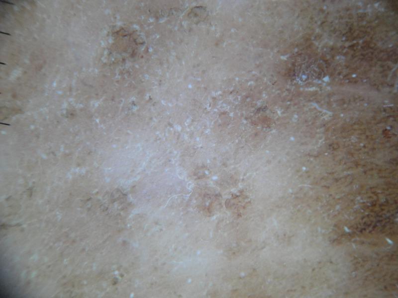 https://cdn.ncbi.nlm.nih.gov/pmc/blobs/f468/3919838/89e751a5f2e0/dp0401a05g001c.jpg