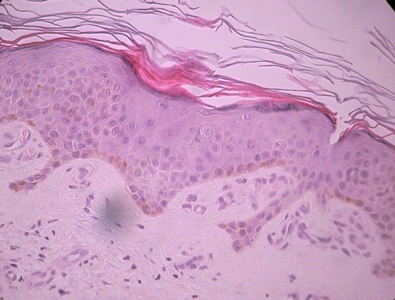 https://cdn.ncbi.nlm.nih.gov/pmc/blobs/f468/3919838/c46eceba6e93/dp0401a05g001b.jpg