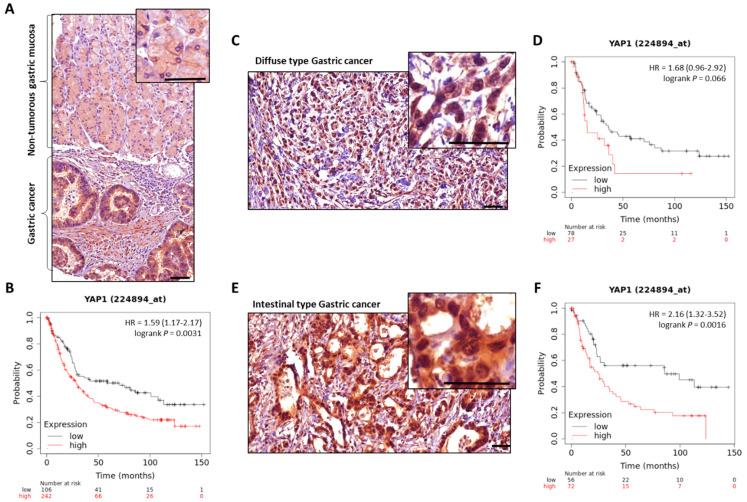 https://cdn.ncbi.nlm.nih.gov/pmc/blobs/f46c/9105983/e39dcd0eab4d/cancers-14-02282-g003.jpg