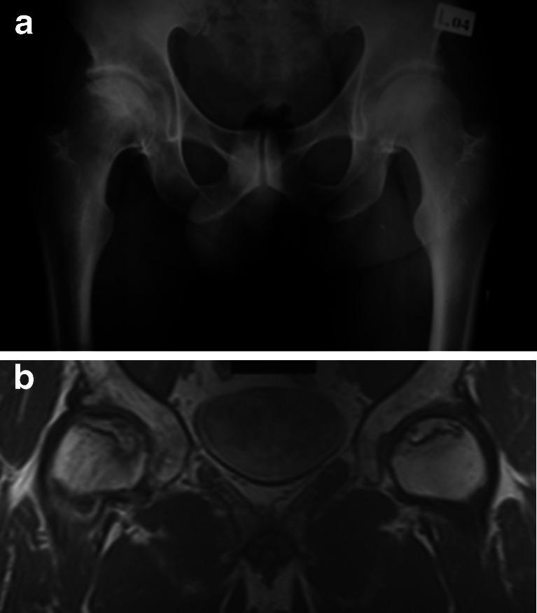 https://cdn.ncbi.nlm.nih.gov/pmc/blobs/f477/3685672/44ac666c33e0/264_2013_1892_Fig1_HTML.jpg